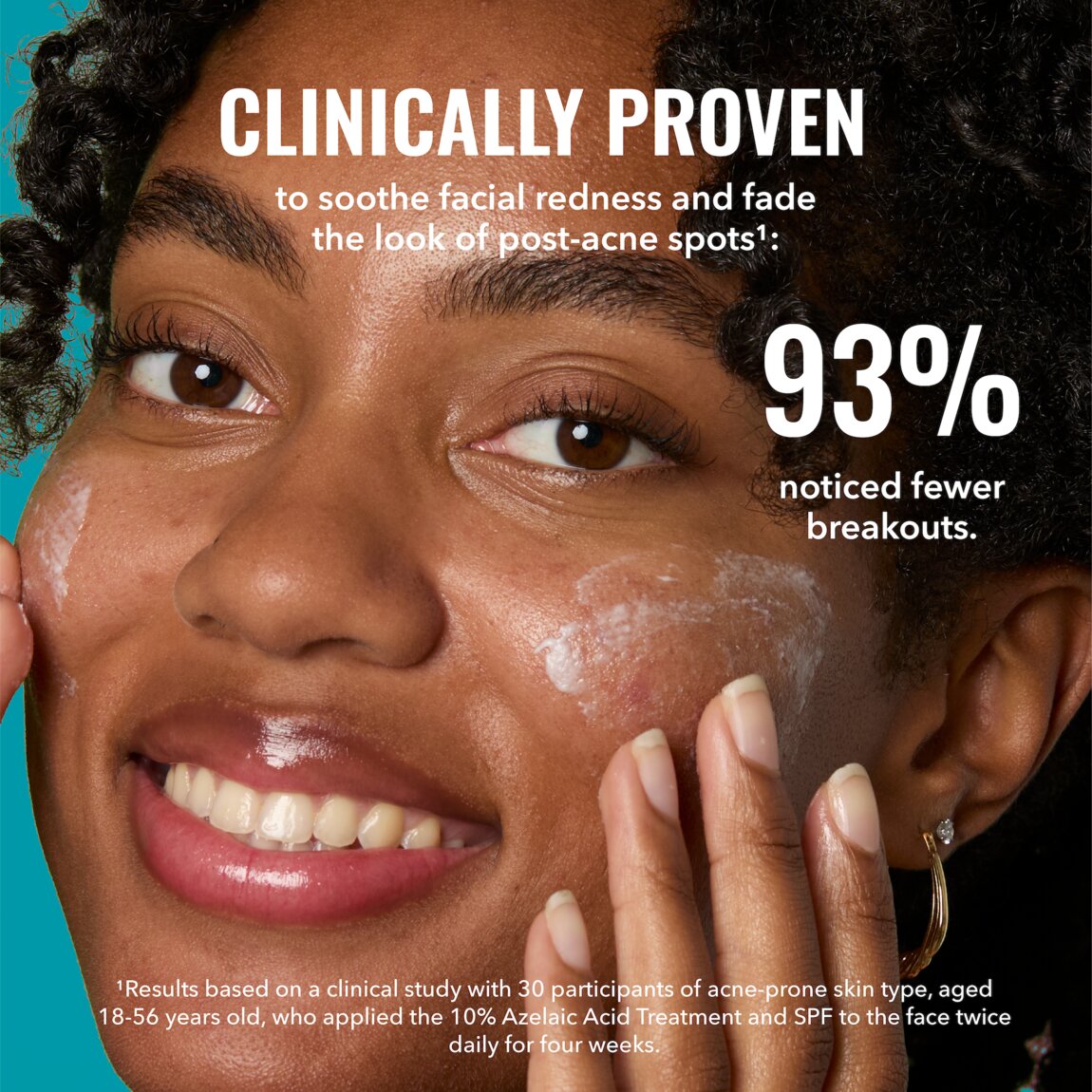 10-azelaic-acid-treatment-a9 zb_p.jpg