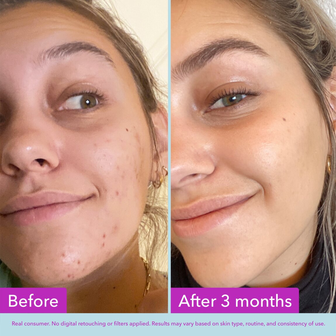niacinamide-brightening-toner-v1 zb_p.jpg