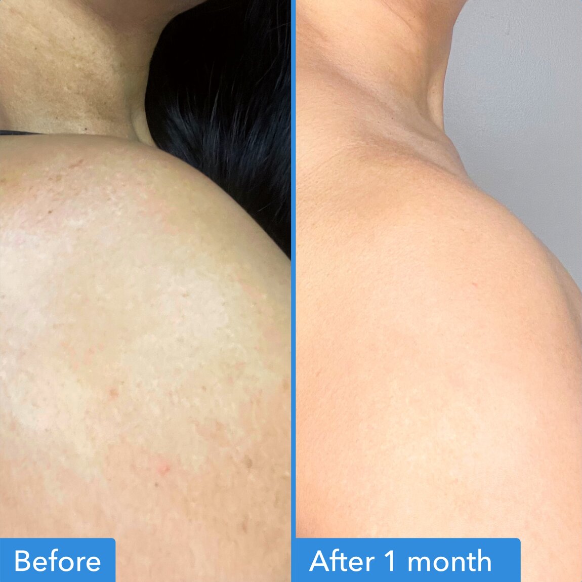 discoloration-correcting-body-treatment-z3 zb_p.jpg