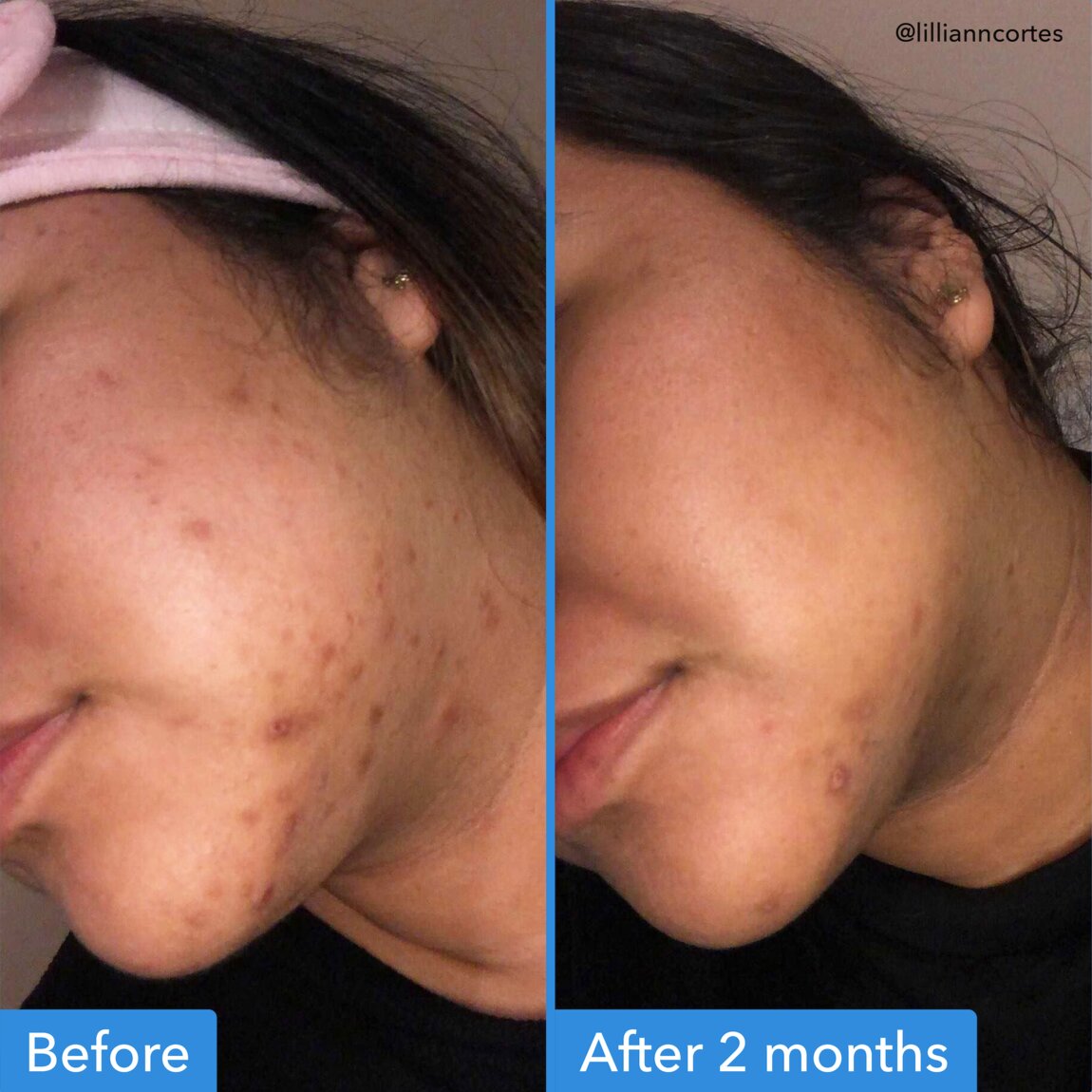 discoloration-correcting-serum-v2 zb_p.jpg